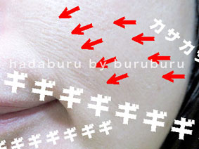 肌